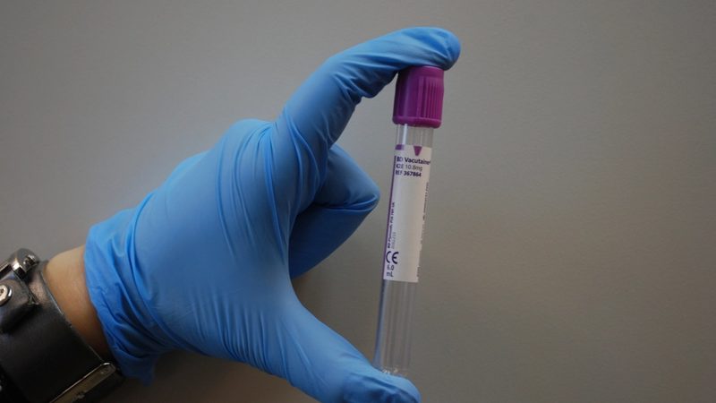 Le test PSA : ce que signifie un chiffre élevé