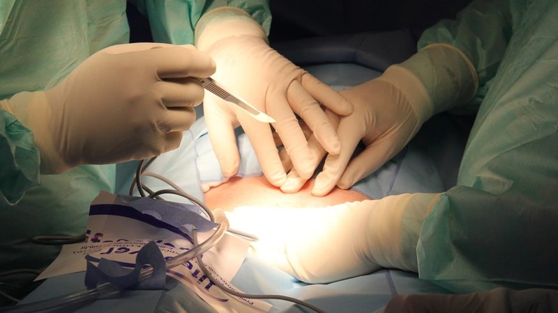 Chirurgie robotique : quels cancers en profitent