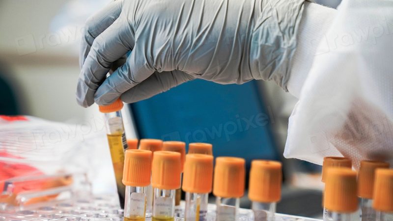 Greffe de cellules souches, étape par étape